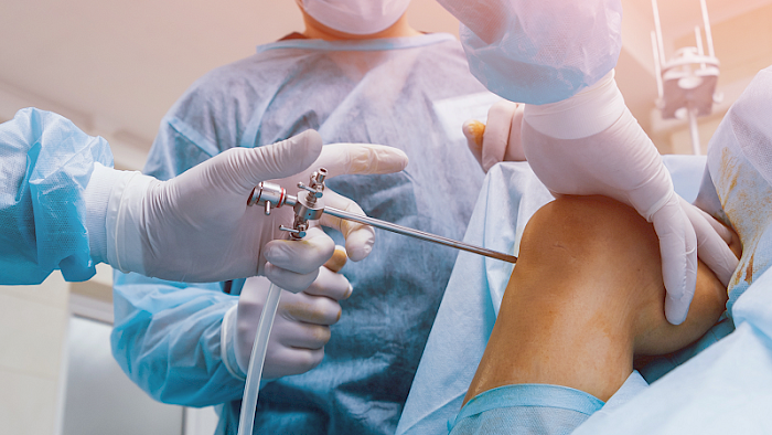 Knieschmerzen beim Sport: Was ist zu tun, wenn das Knie schmerzt? Knieschmerzen beim Sport: Was ist zu tun, wenn das Knie schmerzt?